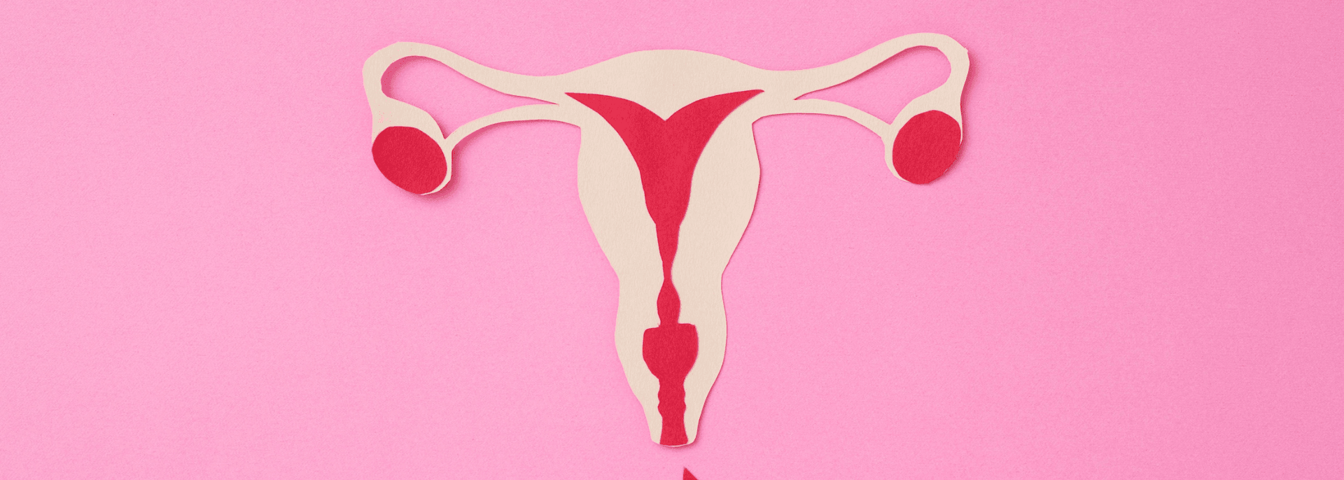 Przyczyny bólu miesiączkowego (poza endometriozą)