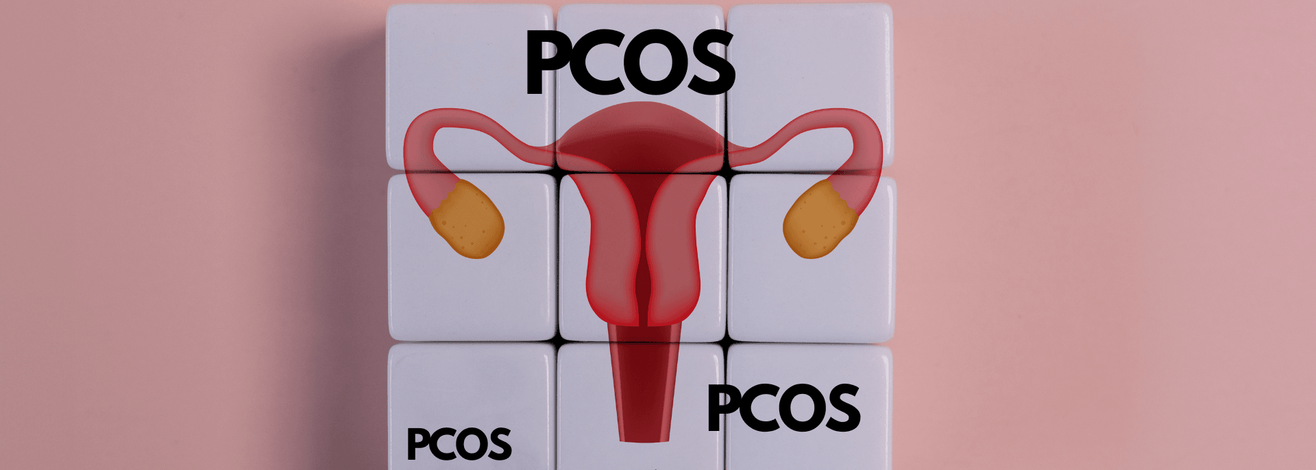 Suplementacja przy PCOS 